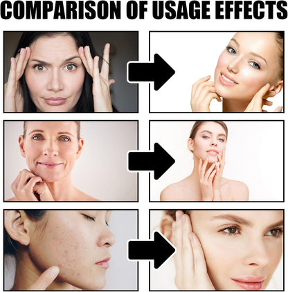 Crema Sangre De Dragón, 30Ml Suero Antiarrugas Sangre De Dragón Y 30G Crema Antiarrugas Sangre De Dragón, Reduce La Pigmentación Y Las Líneas De Expresión, Serum